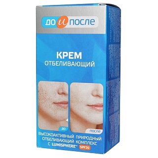 До и после Отбеливающий крем 100мл (Твинс Тэк)